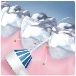 Oral B Oral-B AquaCare 4 Waterflosser Irrigator 9 Oral B Oral-B AquaCare 4 Waterflosser Irrigator -Electronics Shop oral b aquacare 4 waterflosser irrigator5